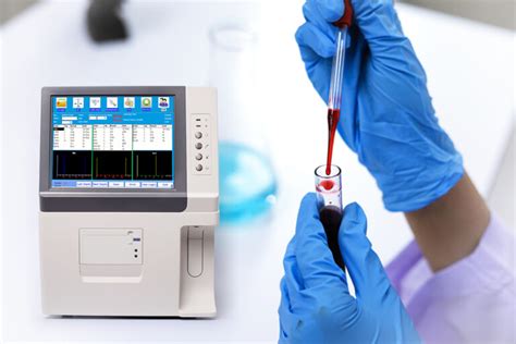 blood test analyzer online free